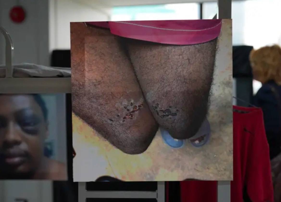 曼谷外国记者协会正在举办一场展览，讲述缅甸妙瓦底诈骗园区受害者遭遇的虐待